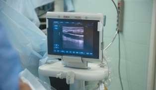 Opcións de diagnóstico para varices pélvicas